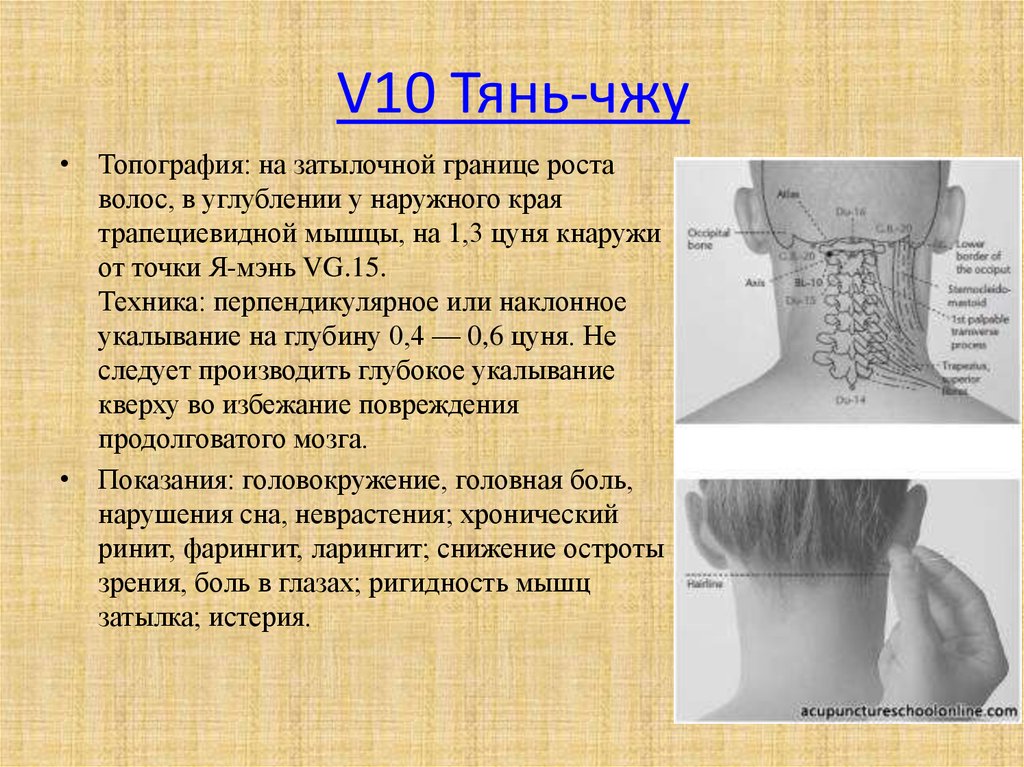 V точку. «Тянь-Чжу v 10». Точка v10. Тянь-Чжу точка акупунктуры. Тянь-Чжу расположение.