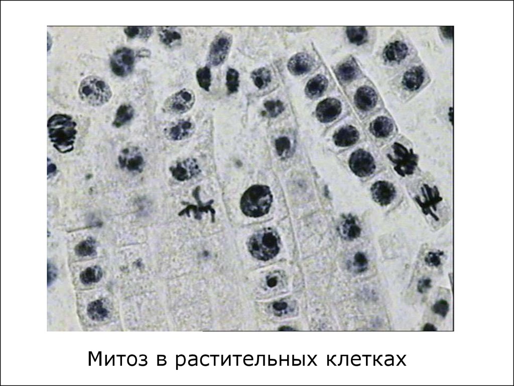 Единичные митозы. Митоз в клетках краевой зоны печени аксолотля. Митоз животной клетки краевая зона печени аксолотля. Митоз животной клетки печени аксолотля. Препарат митоз животной клетки краевая зона печени аксолотля.