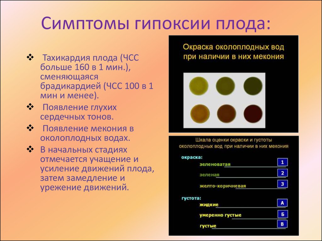 Гипоксия при беременности