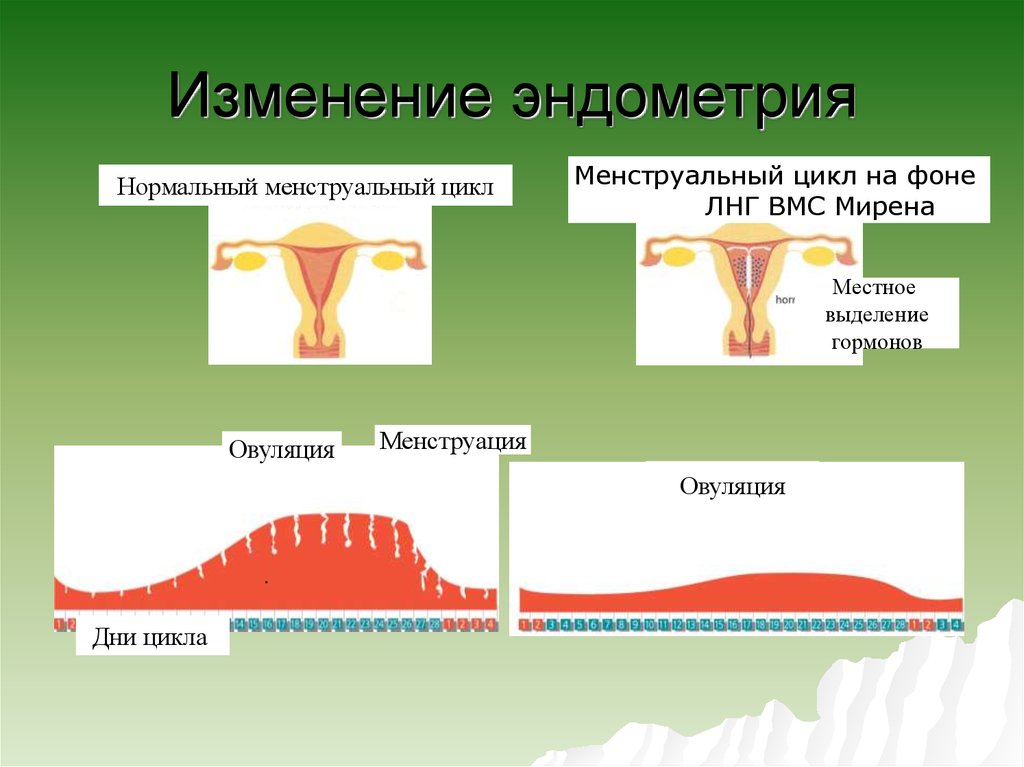 Эндометрий 4 3. Эндометрий 1 фазы менструального цикла. Толщина эндометрия менструальный цикл. Толщина эндометрия 1 фаза менструационного цикла. Эндометрий фазы цикла эндометрия менструационного.