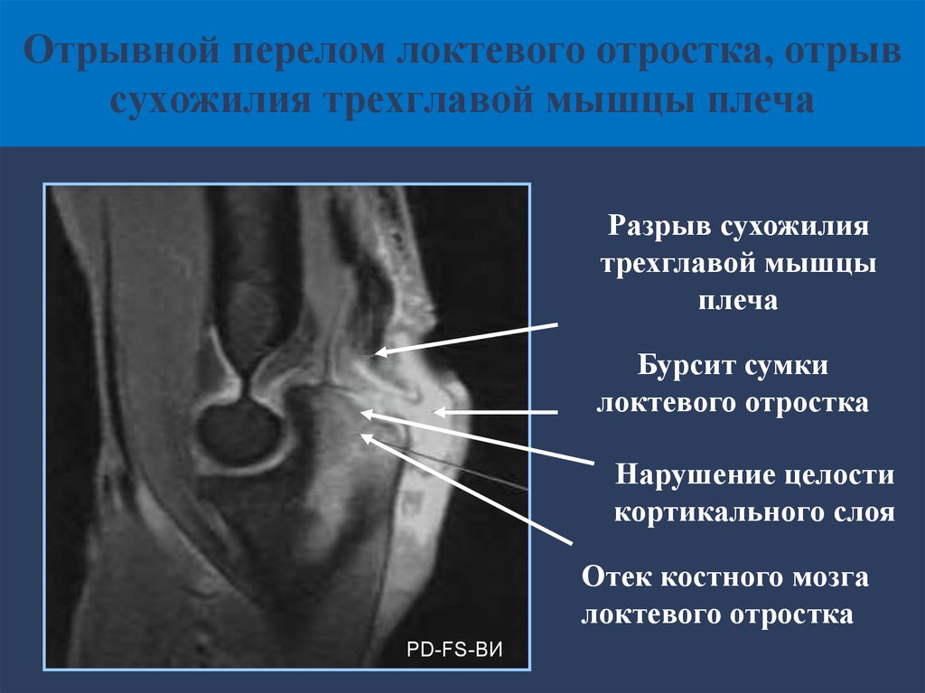 В каких случаях показана компьютерная рентгеновская томография пораженного сустава тест