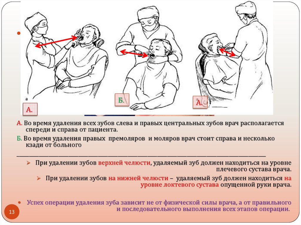 Операция пдр схема