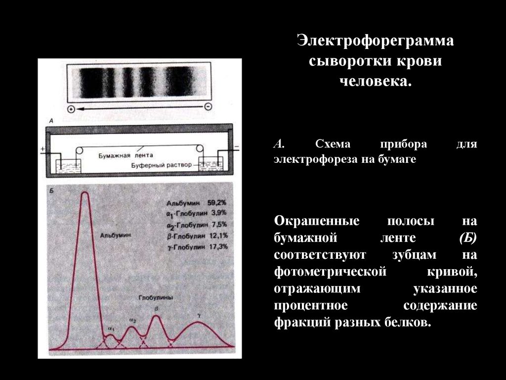 М градиент. Нормальная Электрофореграмма белков сыворотки крови. Метод электрофореза сыворотки крови. Электрофорез белковых фракций сыворотки. Электрофорез белков сыворотки крови принцип метода.