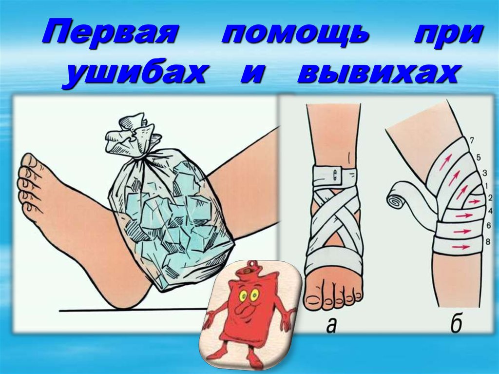 Первая помощь при ушибах и вывихах