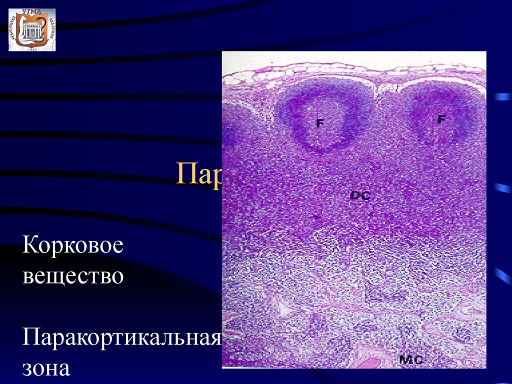 Лимфоидные узелки. Лимфоидные узелки трабекулы. Кортикальная и паракортикальная зона. Интердигитирующие клетки.