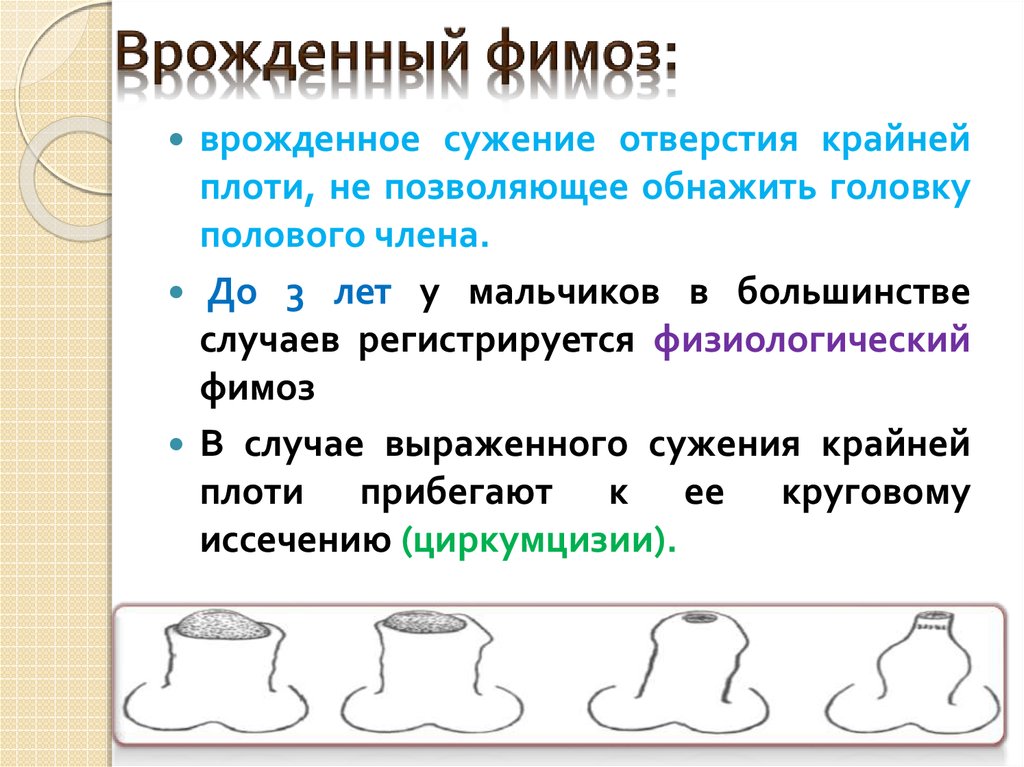 Как у мальчика в 5 лет должна открываться головка фото