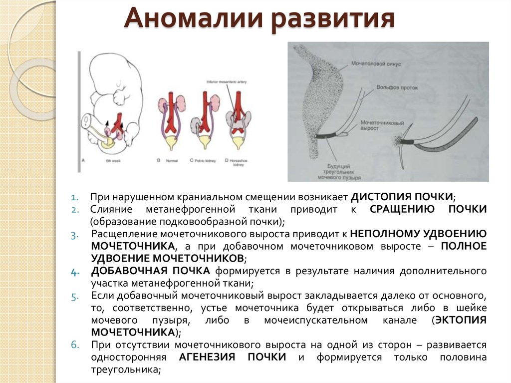 Отсутствие развития органа