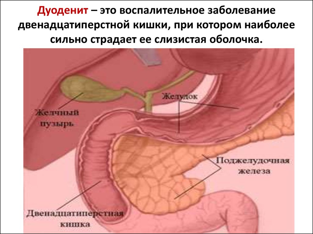 Воспаление поджелудочной железы желчного пузыря