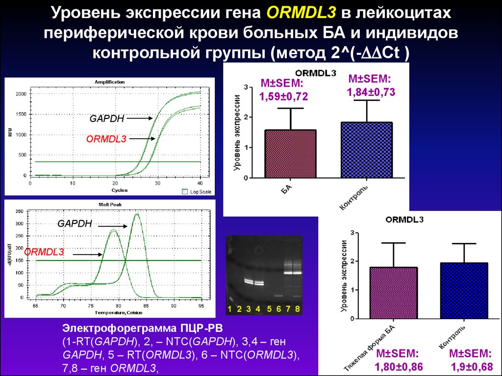 Экспрессивный уровень