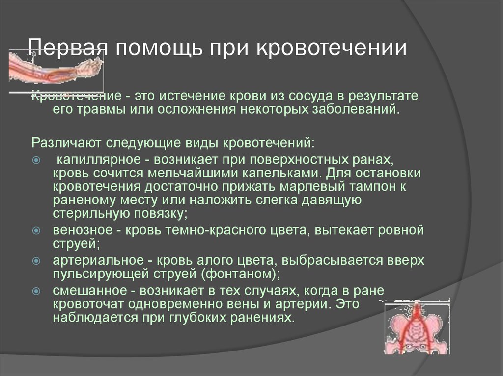 Действие при наружном кровотечении. Основные оказания первой помощи при кровотечениях. Оказание первой доврачебной помощи при наружном кровотечении.. Первая медицинская помощь при кровотечениях кратко. Памятка оказание первой помощи при кровотечениях.