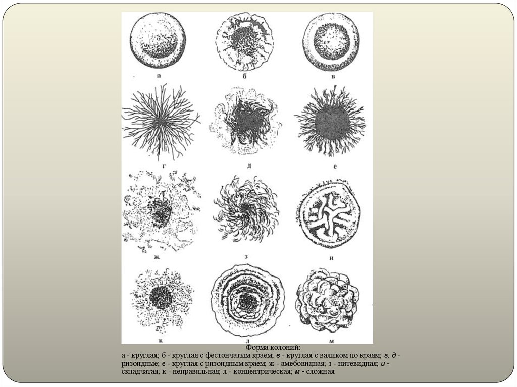 Схема описания колоний бактерий
