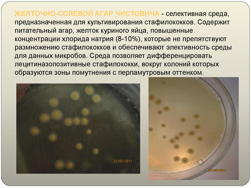 Staphylococcus aureus среда. Желточно-солевой агар (ЖСА). Золотистый стафилококк на ЖСА. Питательная среда для культивирования стафилококков. Среда желточно солевой агар.
