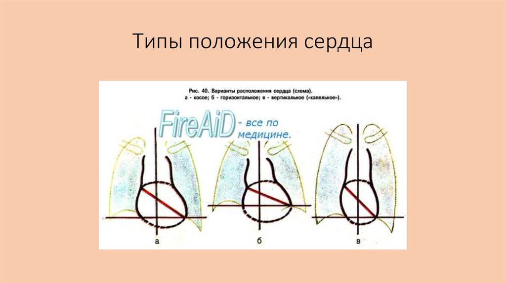 При смене положения сердце