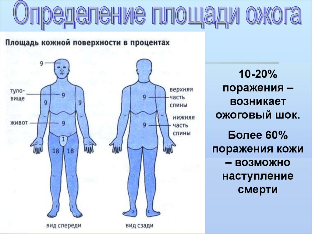 Пл тела. Площадь кожи поверхности тела в %. Ожоги правило ладони правило 9. Площадь тела правило девяток.