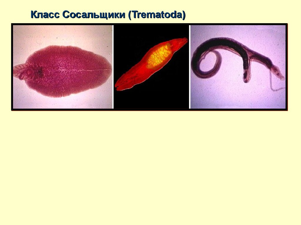 Сосальщики в организме человека. Черви-сосальщики – трематоды.. Трематоды трематоды. Класс трематоды представители.