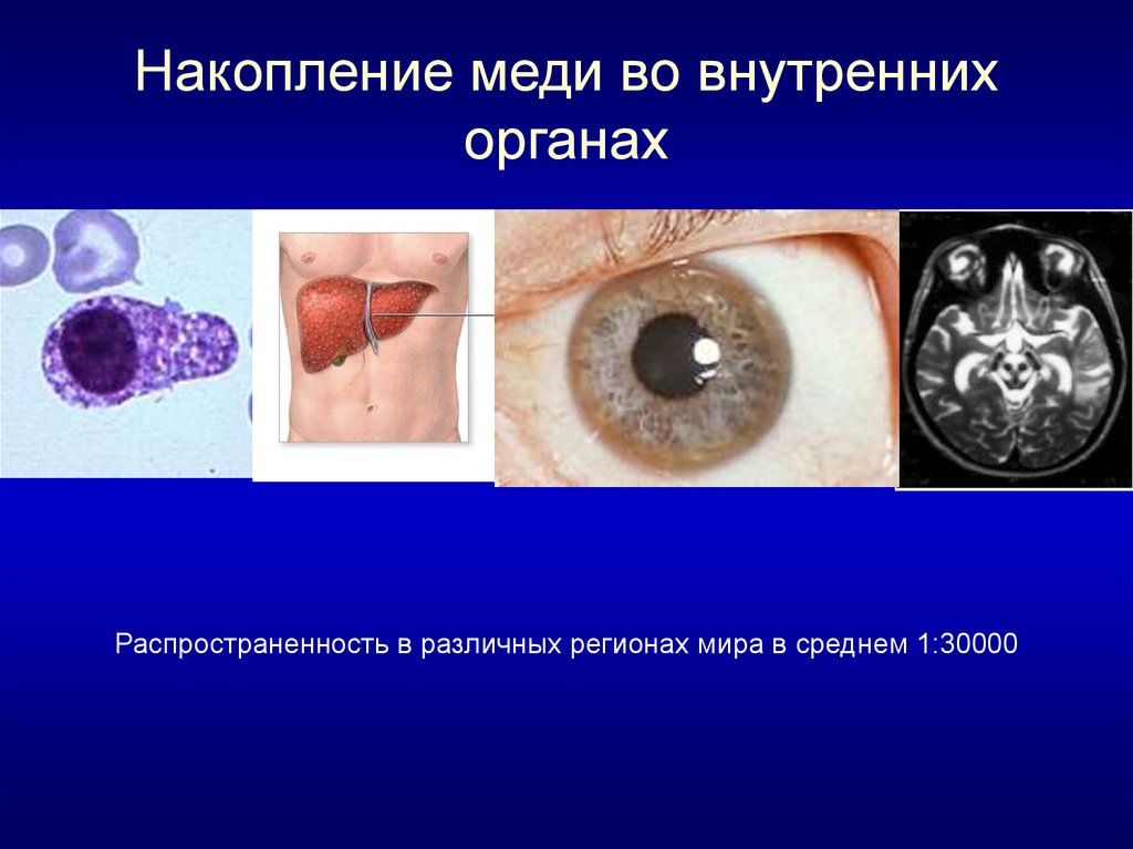 Картинка клизма работает во внутренних органах