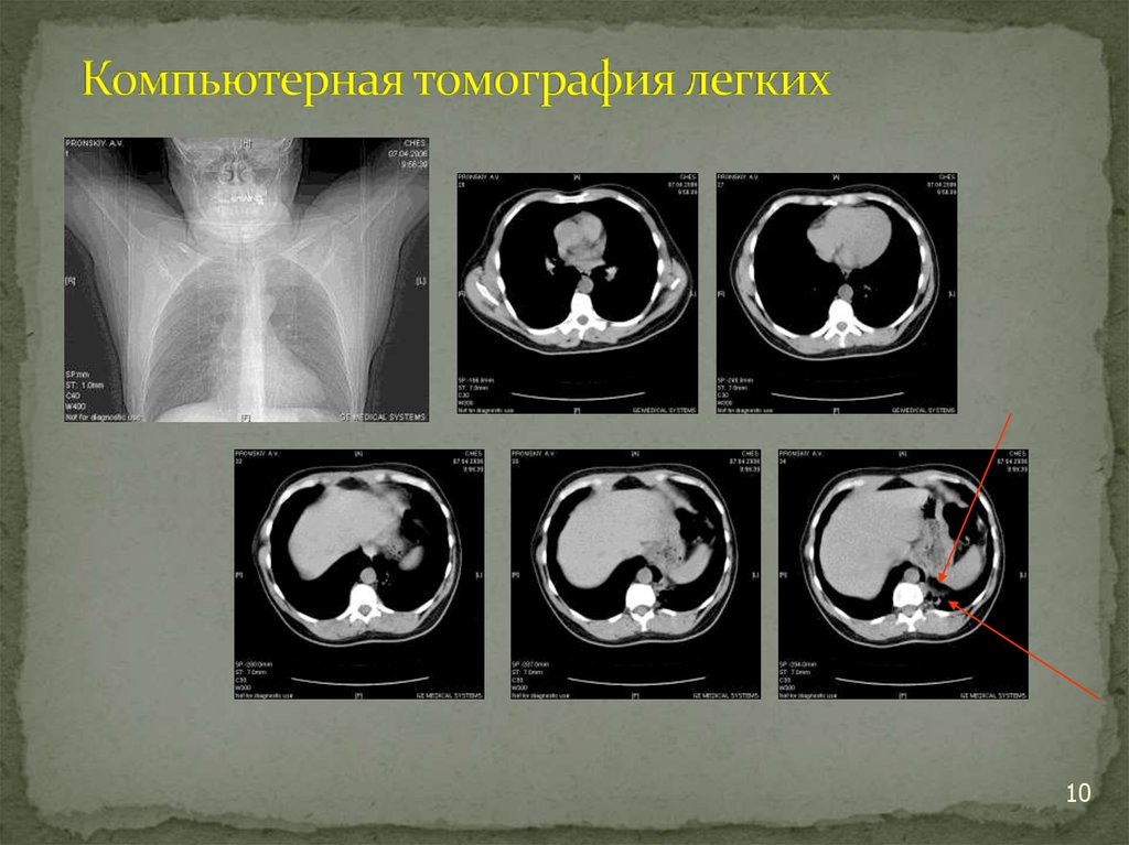 Где сделать компьютерную томографию легких нижний новгород