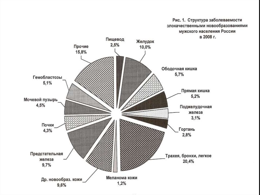 Распространенные заболевания в россии. Диаграмма онкологических заболеваний. Структура онкологических заболеваний 2021. Структура онкологических заболеваний в России 2020.