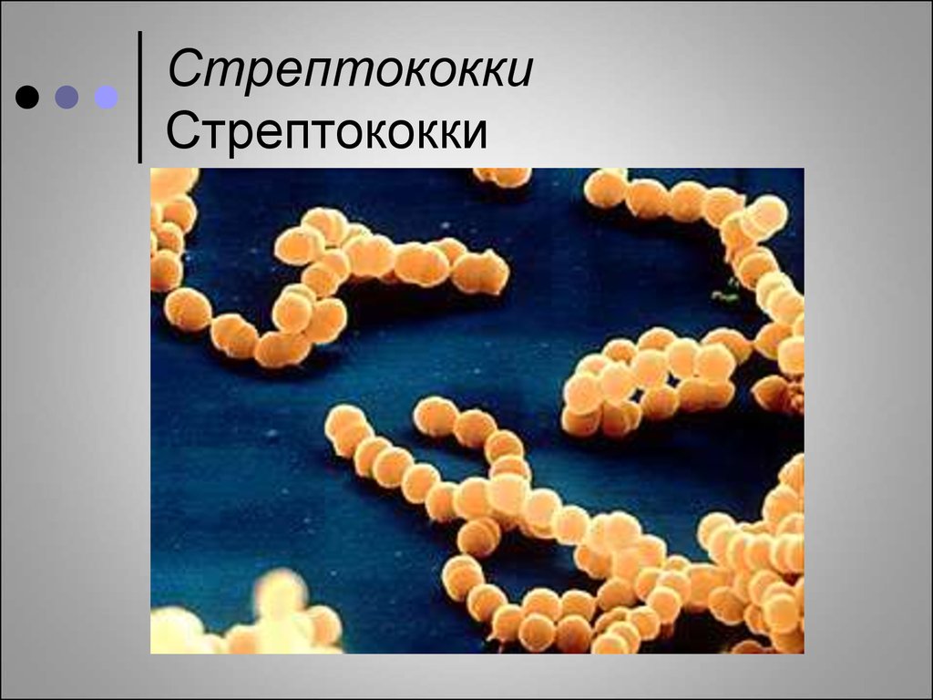 Стрептококк. Молочнокислые бактерии стрептококки. Молочнокислый стрептококк (Streptococcus lactis). Streptococcus thermophilus стрептококк термофильный. Штамм молочнокислых бактерий Streptococcus thermophilus.