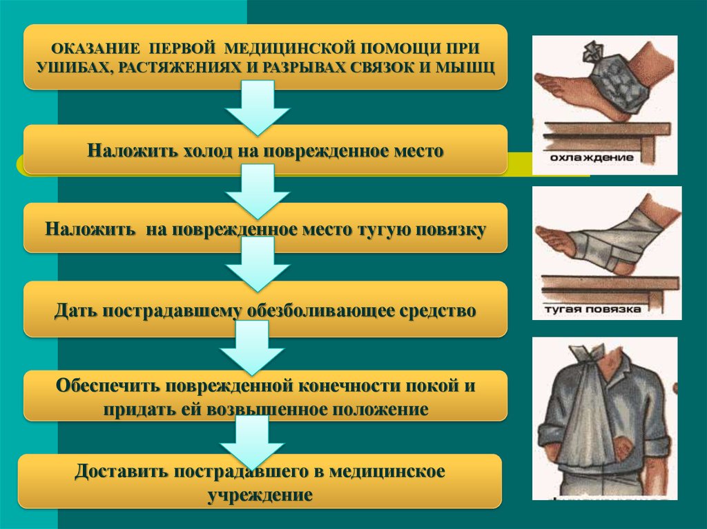 Оказание первой помощи при повреждении мышц. Алгоритм оказания первой помощи при ушибах, вывихах и переломах. Оказание первой помощи при переломах вывихах ушибах. Оказание первой доврачебной помощи при ушибах. Алгоритм оказания первой помощи при ушибах.