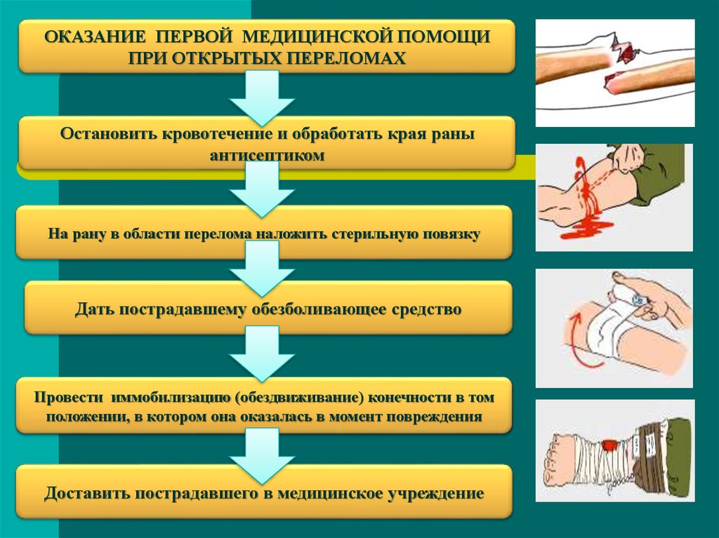 Последовательность действий при оказании помощи. Алгоритм действий при открытом переломе. Алгоритм оказания первой доврачебной помощи при открытом переломе. Алгоритм ПМП при переломах. Порядок действий при оказании ПМП.