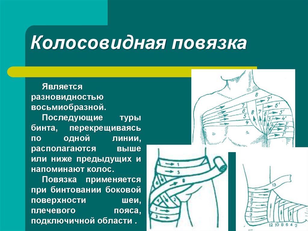 Повязка при ранении плеча