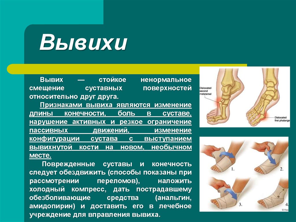 Что такое вывих. Переломы и вывихи общая хирургия. Вывих характеристика повреждения. Вывих суставов признаки повреждения первая помощь.