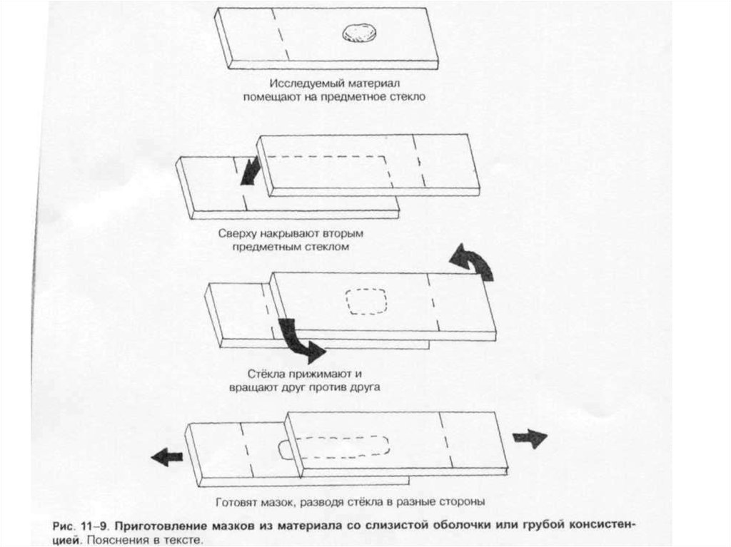 Техника приготовления. Методы приготовления мазка микробиология. Приготовление препарата мазка микробиология. Методика приготовления мазка препарата. Методика приготовления мазка препарата микробиология.