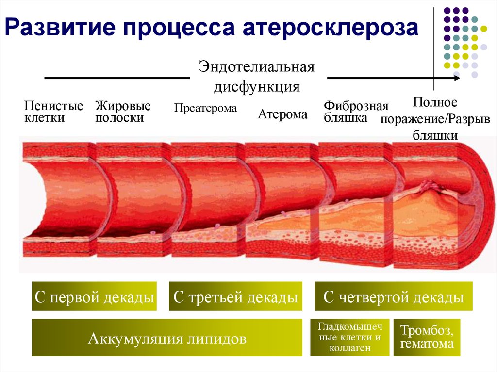 Атеросклероз презентация госпитальная терапия