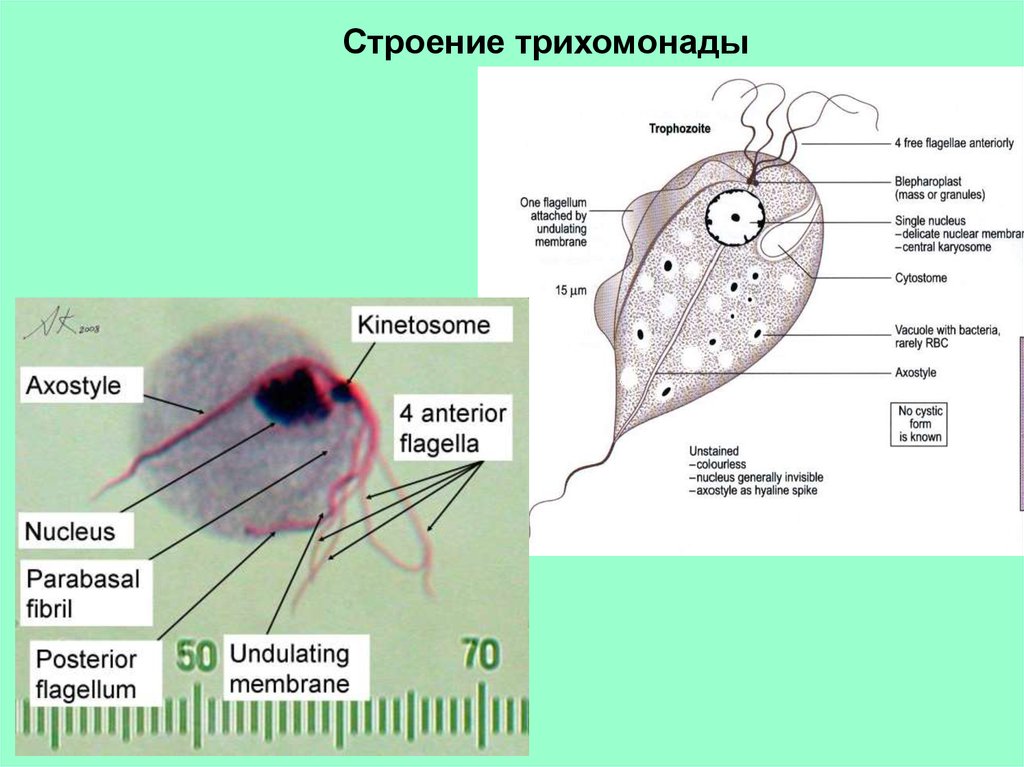 Строение трихомонады рисунок с подписями