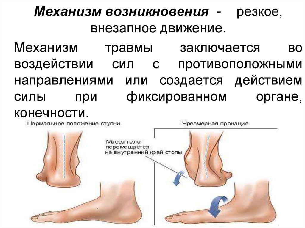 Резкое появление