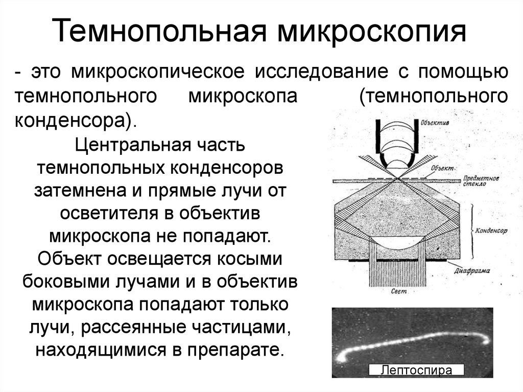 Метод поли. Принцип темнопольной микроскопии. Оптическая темнопольная микроскопия. Микроскопия в темном поле (темнопольная микроскопия). Разрешающая способность темнопольного микроскопа.