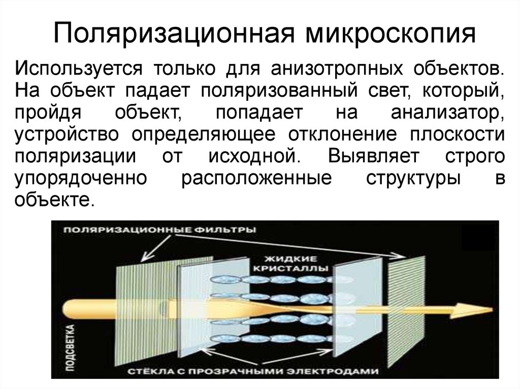 Объект использоваться. Поляризационная микроскопия мышечного волокна. Метод поляризационной микроскопии. Полимеризационная микроскопия. Поляризационный микроскоп.