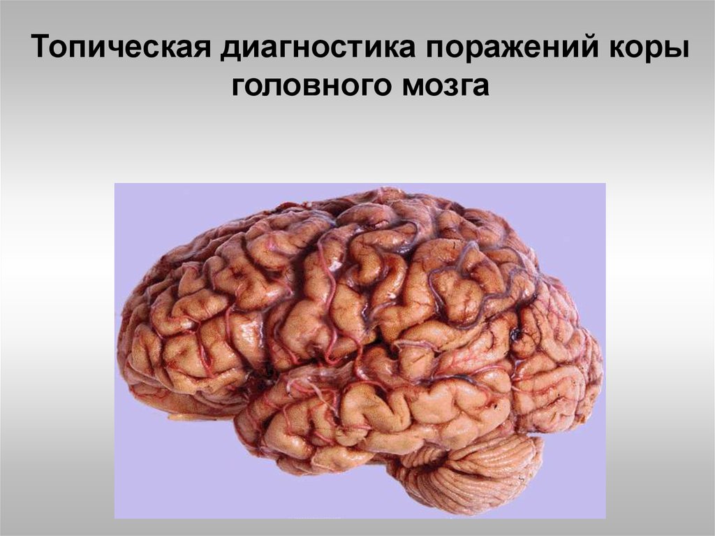 Признаки характеризующие кору головного мозга. Поражение коры головного мозга.