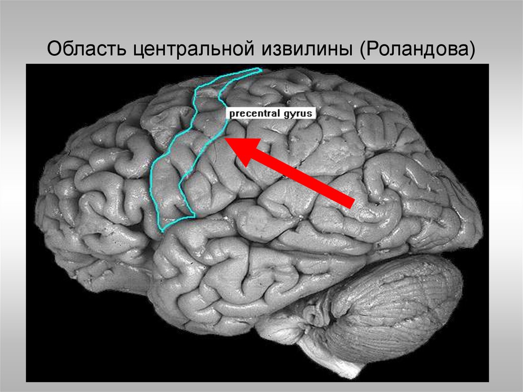 Центральная извилина мозга. Прецентральная извилина головного мозга. Опухоль прецентральной извилины. Головной мозг борозды роландова.