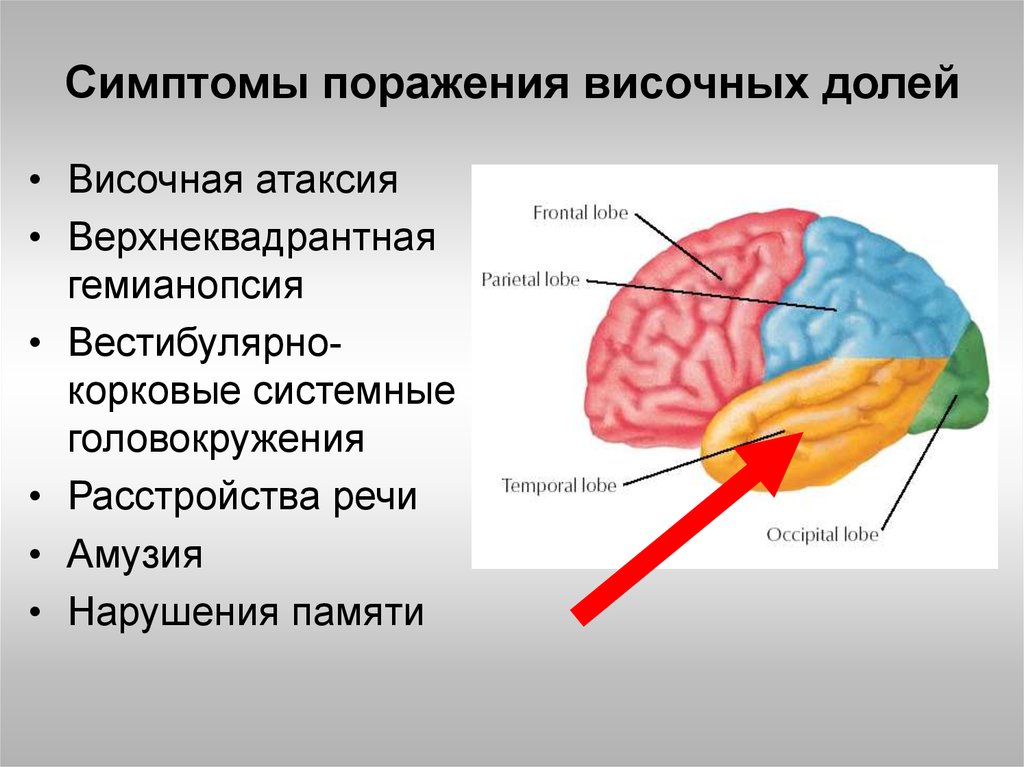 Раздражение коры головного мозга. Симптомы поражения коры височной доли головного мозга. 2) Синдром поражения височной доли головного мозга. Симптомы поражения коры височной доли. Анатомия лобная доли мозга синдромы поражения головного мозга.