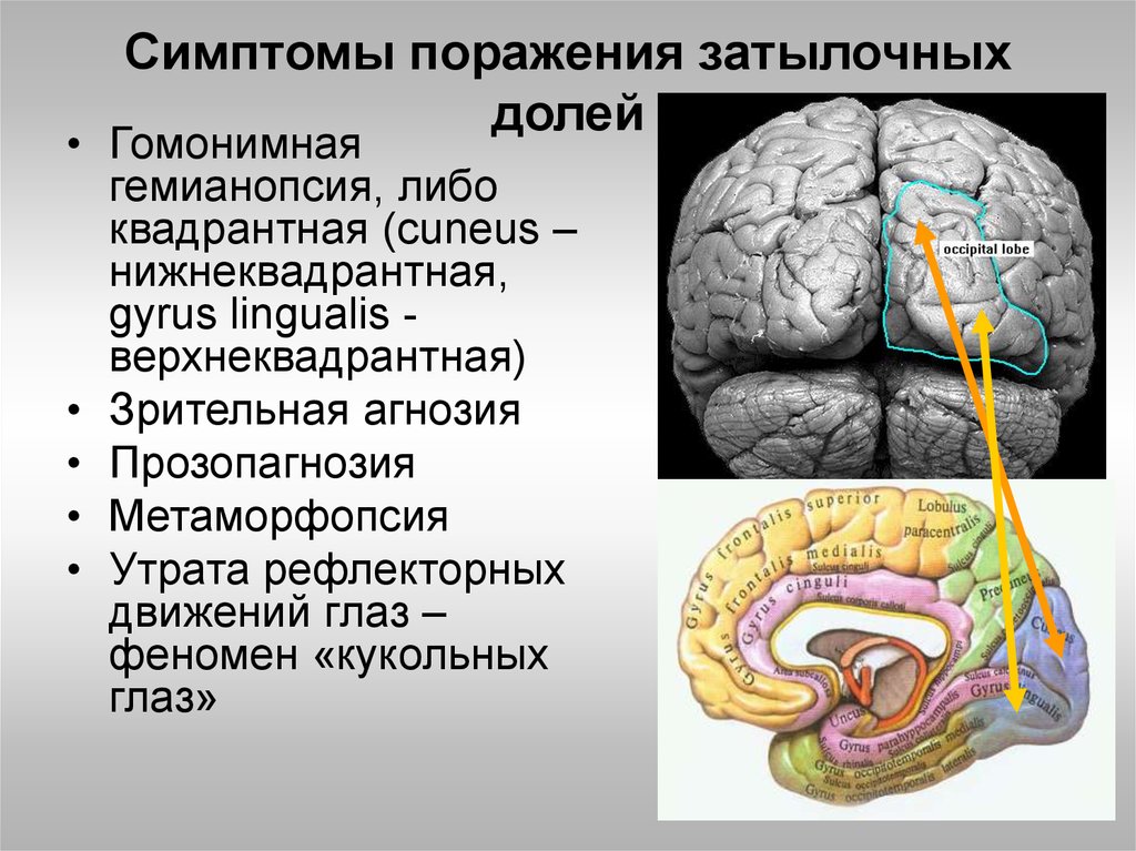 Признаки повреждения мозга