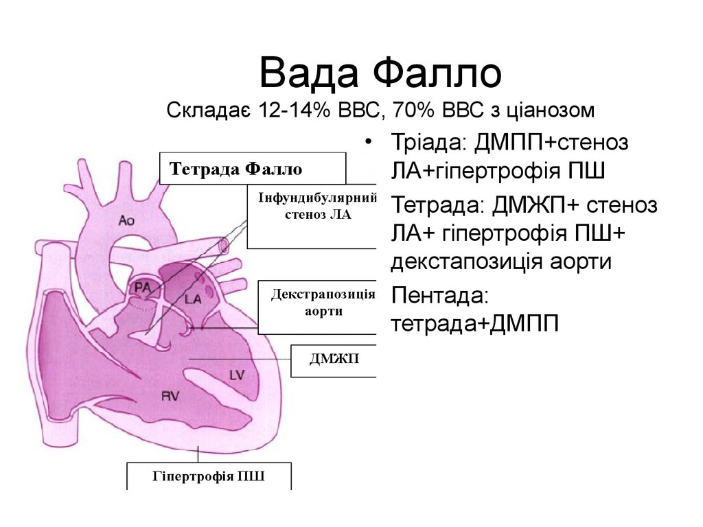 Триада фалло презентация