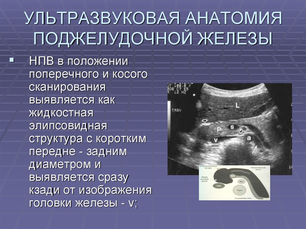 Перед узи поджелудочной. УЗИ брюшной полости норма поджелудочной железы. УЗИ анатомия поджелудочной железы. УЗИ поджелудочной железы Изранов. Ультразвуковая анатомия поджелудочной железы.