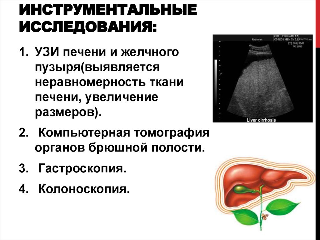 Анализы для печени и желчного. УЗИ исследование желчного пузыря. Ультразвуковое исследование при патологии печени. Ультразвуковое исследование печени и желчного пузыря. Инструментальные методы исследования печени.