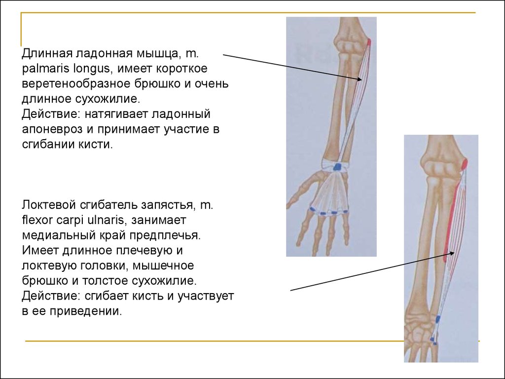 Длинные мышцы кисти. Длинная ладонная мышца m. Palmaris Longus. Локтевой сгибатель кисти. Длинная ладонная мышца, локтевой сгибатель кисти.. Palmaris Longus мышца.