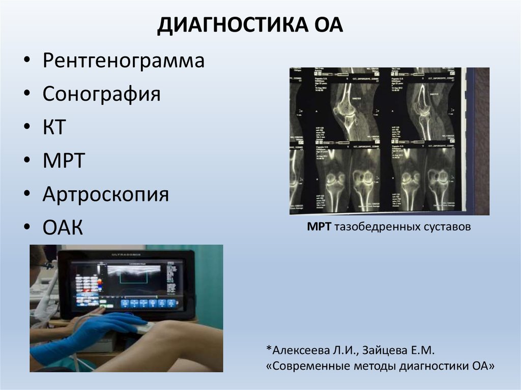 деформирующий остеоартроз обследование. деформирующий остеоартроз лабораторные исследования. лабораторные исследования при остеоартрозе. остеоартроз исследования. диагностика деформирующего остеоартроза.