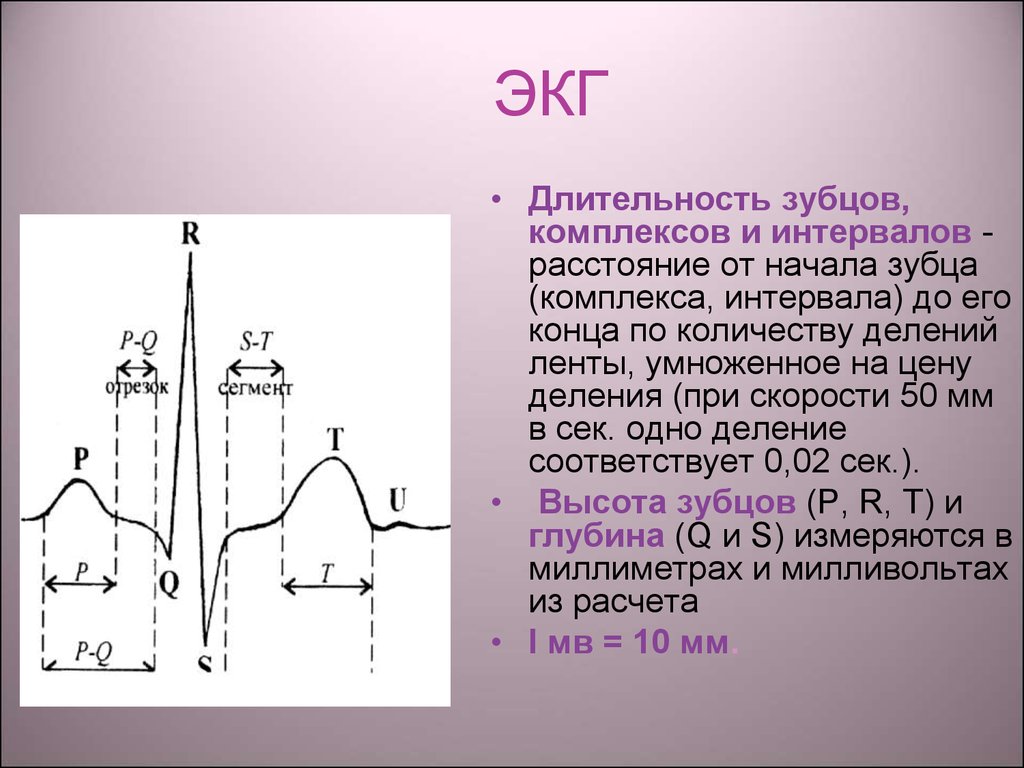 Описание экг. Длительность зубцов и интервалов ЭКГ. Нормальная ЭКГ зубцы сегменты интервалы. Характеристика нормальной ЭКГ зубцы сегменты интервалы. ЭКГ С обозначением зубцов интервалов и комплексов.