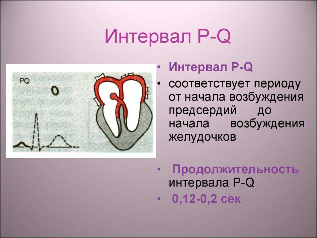 Р q. Интервал р—q. Интервал возбуждения желудочков. Интервал р q больше 012. Интервал р-q ответ 1.