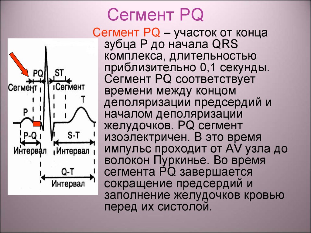 Р q. Сегмент PQ на электрокардиограмме - это. Подъем сегмента PQ на ЭКГ. QRS интервал PQ. Интервал PQ на ЭКГ отражает.