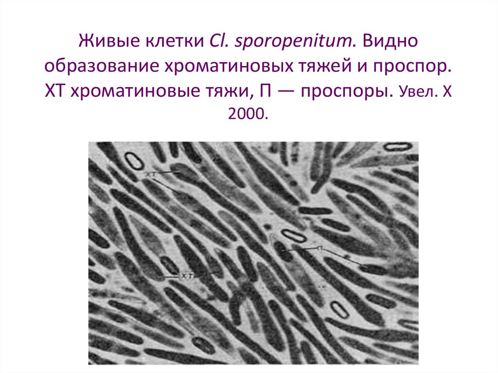 Живые клетки Cl. sporopenitum. Видно образование хроматиновых тяжей и проспор. XT хроматиновые тяжи, П — проспоры. Увел. X 2000.