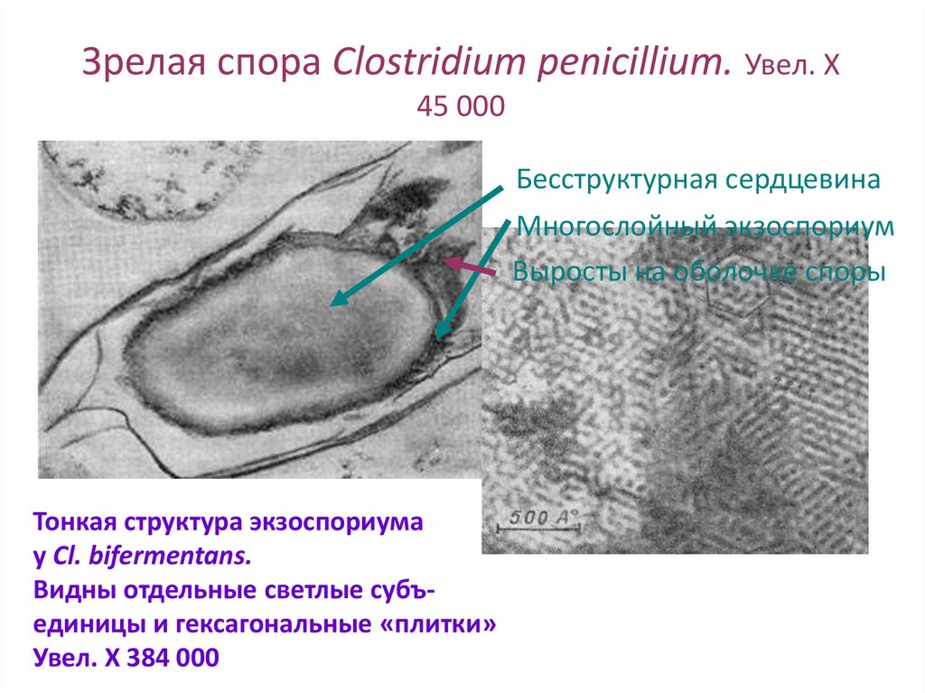 Зрелая спора Clostridium penicillium. Увел. Х 45 000