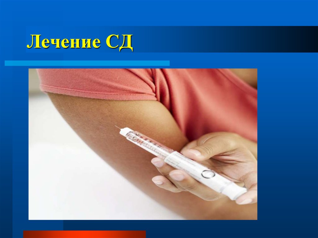 Лечение СД