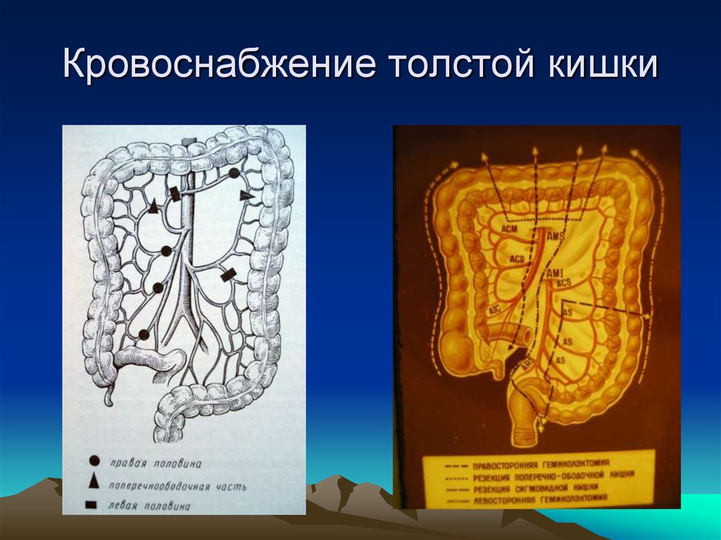 Кровоснабжение толстой кишки схема