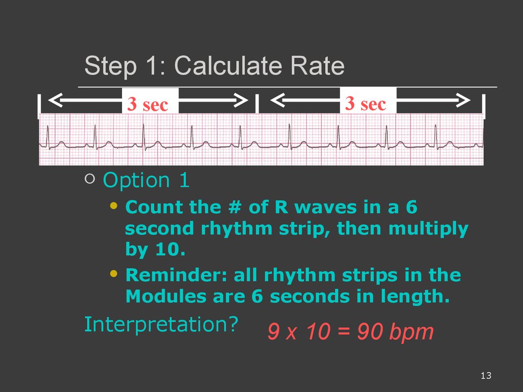 Ecg Interpretations How To Analyze A Rhythm Normal Sinus Rhythm Heart Arrhythmias Diagnosing A Myocardial Infarction Prezentaciya Onlajn